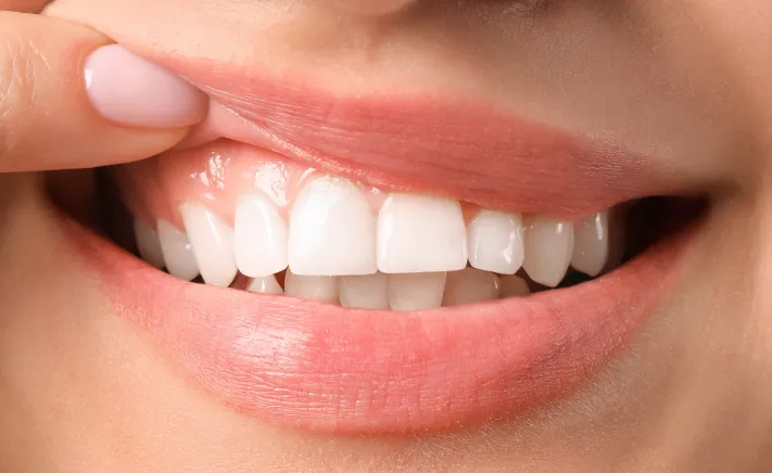 Arestin® Gum Treatment at Copper Hills Dental