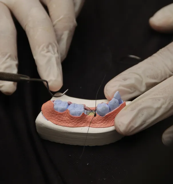 Extraction Site Preservation at Copper Hills Dental