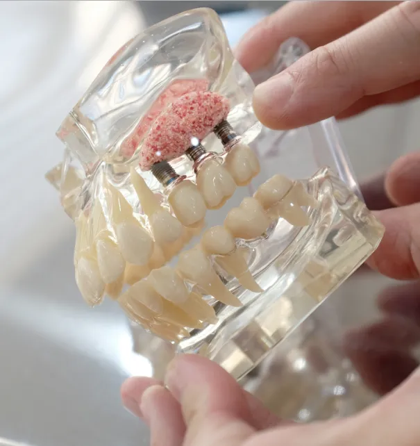 Sinus Lifts at Copper Hills Dental