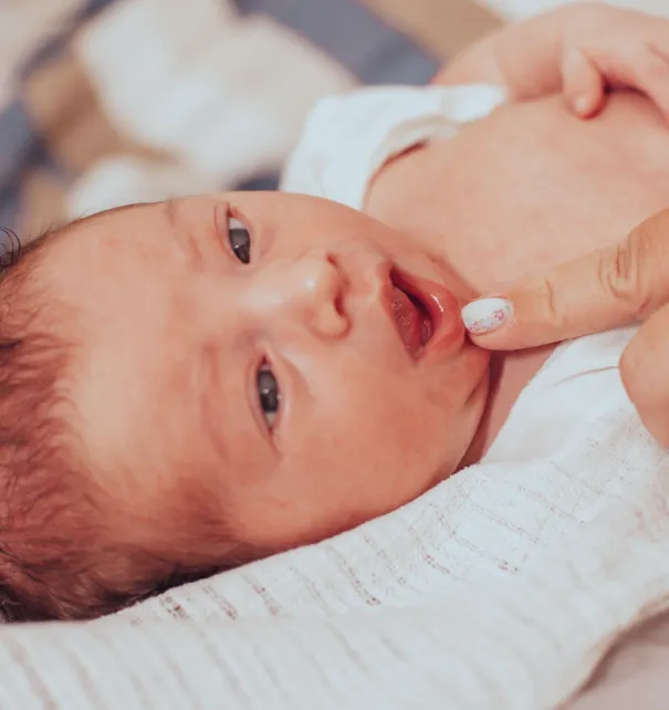 Frenectomy at Copper Hills Dental